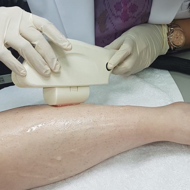 IMG_20170726_173515_525